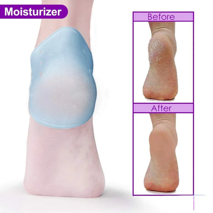 2PCS Heel Cushion Gel Heel Protector for Plantar Fasciitis Achilles Tendonitis Bone Spur Aching Feet Relieve Pain Pedicure Tools